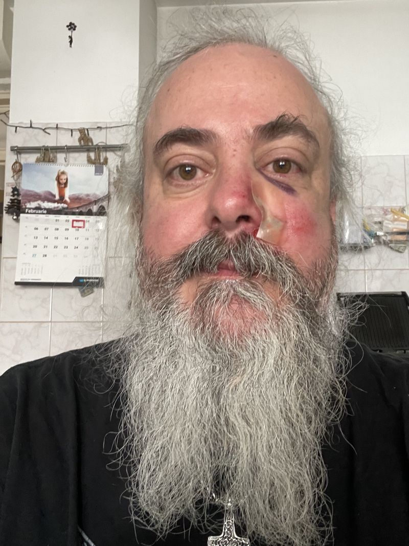 Celebrul solist al trupei Bucovina, atacat după concert: ,,Fără vorbe, fără tâlhărie, fără nimic”