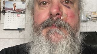 Celebrul solist al trupei Bucovina, atacat după concert: ,,Fără vorbe, fără t&acirc;lhărie, fără nimic&rdquo;