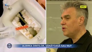 Albirea dinților, sănătoasă sau nu