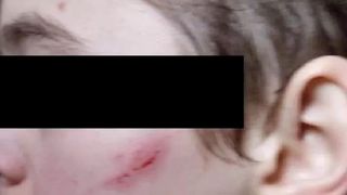 Bătut de colegi și aruncat în tomberon - Afirmațiile la adresa unui elev din Bacău, care se crede că ar fi fost persecutat la școală