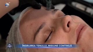 &Icirc;ngrijirea tenului, misiune continuă