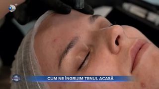 Cum ne &icirc;ngrijim tenul acasă