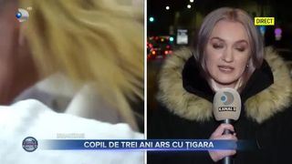 Copil de trei ani ars cu țigara