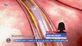 Pacienți &icirc;mbolnăviți cu bună știință