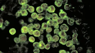 amoeba microscopică numită Naegleria fowleri. 