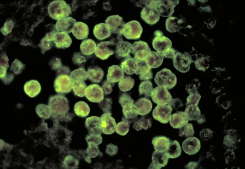 amoeba microscopică numită Naegleria fowleri. 