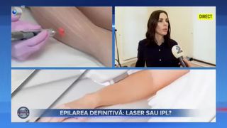 Epilarea definitivă - laser sau IPL