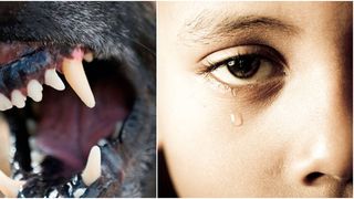 VIDEO- Un copil de 9 ani a fost atacat de un c&acirc;ine agresiv scăpat dintr-o curte, &icirc;n Sectorul 1 al Capitalei