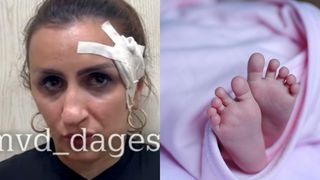 VIDEO |Această femeie și-a vândut copilul pentru a face rost de bani pentru o operație la nas