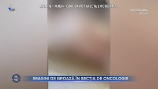 Imagini de groază &icirc;n secția de oncologie