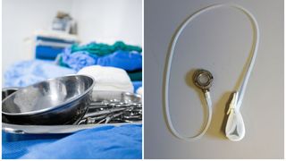 O bandă gastrică este o bandă care este plasată &icirc;n jurul stomacului, cre&acirc;nd o mică pungă spre partea superioară