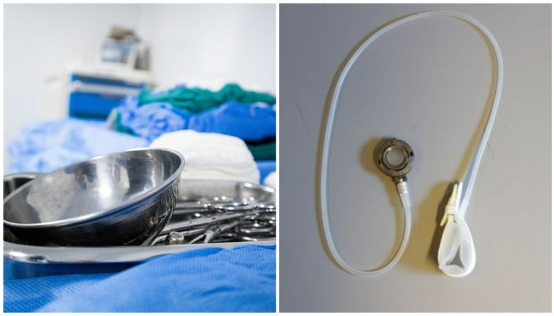 O bandă gastrică este o bandă care este plasată în jurul stomacului, creând o mică pungă spre partea superioară