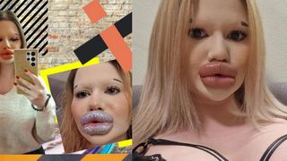 Tânăra cu cele mai mari buze din lume își caută partener. Deși e curtată zilnic, nu și-a găsit fericirea