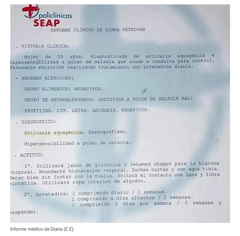 Diana este românca care este alergică la apă: „Mai mulți oameni au crezut că sunt nebună”