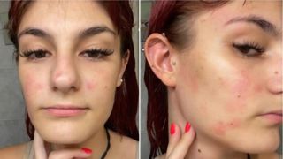 Diana este rom&acirc;nca care este alergică la apă: &bdquo;Mai mulți oameni au crezut că sunt nebună&rdquo;