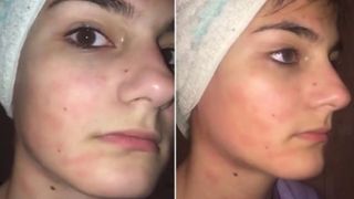 Diana este rom&acirc;nca care este alergică la apă: &bdquo;Mai mulți oameni au crezut că sunt nebună&rdquo;