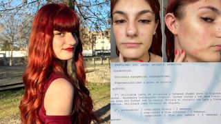 Diana este românca care este alergică la apă: „Mai mulți oameni au crezut că sunt nebună”