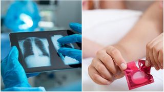 Cum a ajuns o femeie să aibă un prezervativ în plămâni? Cazul care a uimit întreaga lume
