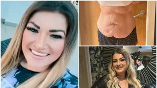 O britanică a fost "măcelărită" după ce și-a făcut o operație estetică de 14.000 de lire sterline în Turcia