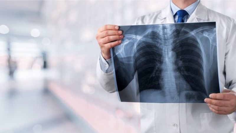Acest test simplu cu două degete îți arată din timp dacă ai cancer pulmonar