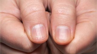 Acest test simplu cu două degete îți arată din timp dacă ai cancer pulmonar