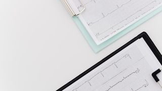 Principalele cauze care provoacă tulburări de ritm cardiac