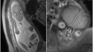 Această imagine de la ecografia de sarcină i-a speriat pe părinți. "Poate fi un extraterestru?!"