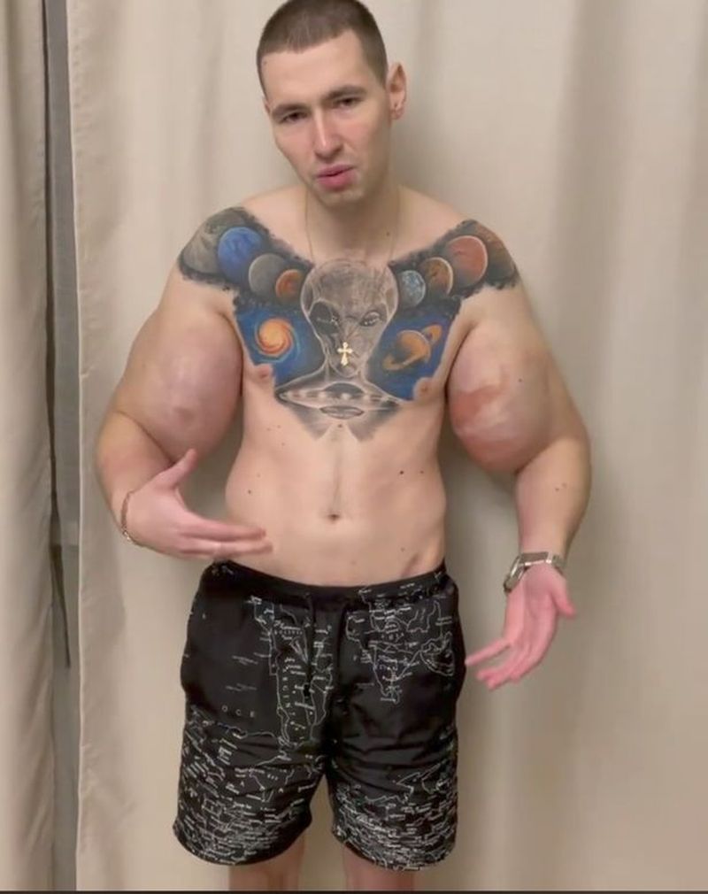 Kirill Tereshin, supranumit „Popeye din Rusia”