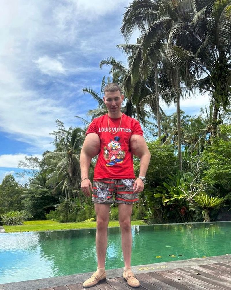 Kirill Tereshin, supranumit „Popeye din Rusia”