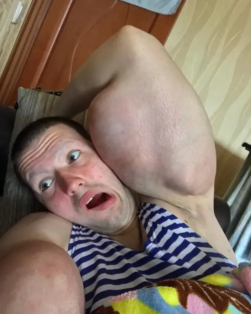 Kirill Tereshin, supranumit „Popeye din Rusia”