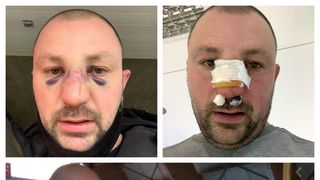 FOTO- Bătaie ca &icirc;n ring pe străzile din Onești: un fost kickboxer a fost făcut K.O. de un fost pugilist