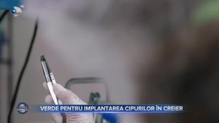 Verde pentru implantarea cipurilor &icirc;n creier