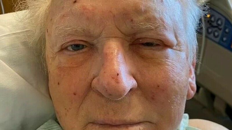 Un pensionar a fost devorat de albine, timp de trei ore. 200 de albine „ucigașe” i-au intrat în gură, ochi, nas și urechi