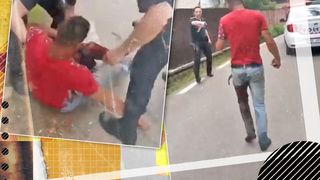 VIDEO - Caz șocant în Huedin! Un bărbat a fost împușcat în picior de doi polițiști: „Uitați, au vrut să-l omoare!”