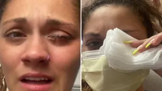 "Am folosit superglue în locul picăturilor de ochi". Ultimele cuvinte ale femeii înainte de a intra în operație de urgență