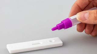 Studiu &icirc;ngrijorător privind efectele Covid-19. Acesta creează probleme pe creier