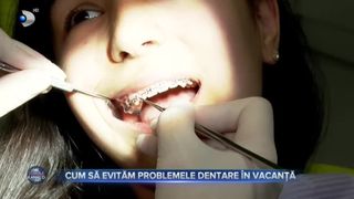 Cum să evităm problemele dentare &icirc;n vacanță