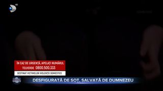 Desfigurată de soț, salvată de Dumnezeu