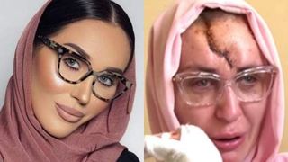 &ldquo;Ultima fotografie &icirc;n care am arătat impecabil&rdquo;. Dana Roba a postat un mesaj pe rețelele de socializare, &icirc;mpreună cu o fotografie făcută &icirc;nainte de tragedie