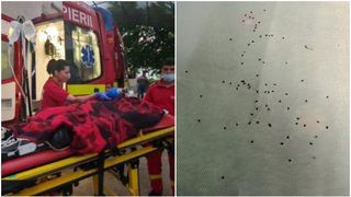 Un copil a fost atacat de un roi de albine. Au fost scoase peste 70 de ace din trupul lui. Caz înfiorător în Botoșani: „Am numărat 74 de ace”