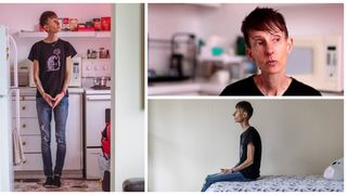 Canada, pe punctul a aproba moartea asistată pentru o femeie de 47 de ani care nu mai vrea să trăiască din cauza anorexiei