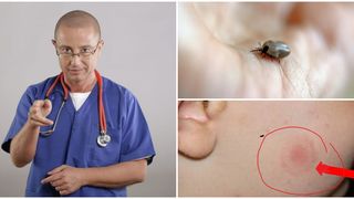 Peste 100 de pacienți s-au prezentat doar de la &icirc;nceputul lunii iulie la Spitalul Clinic de Boli Infecțioase &bdquo;Sf. Parascheva&rdquo; din Iași, din cauza mușcăturilor de căpușă și animale.