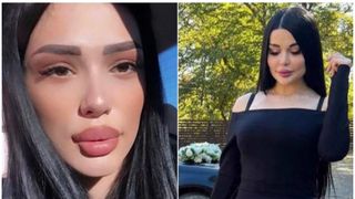 Tânăra Mika de 22 de ani, sfârșit tragic în timpul unei operații estetice. Femeia plătise pentru mărirea feselor