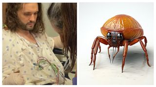 O simplă mușcătură de purice l-a adus pe un bărbat &icirc;n pragul morții. Acestuia i-au fost amputate ambele m&acirc;ini și părți din picioare