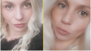 Mămica a cinci copii a &icirc;ncercat să-și scoată singură dinții după ce a consumat cocaină. Medicii nu au mai putut face nimic pentru ea