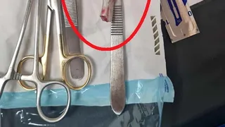 Un accident de bicicletă a ajuns un adevărat coșmar pentru un bărbat. Medicul care l-a operat i-a uitat &icirc;n rană m&acirc;nerul bicicletei. 3 săptăm&acirc;ni de chin