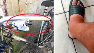 UPDATE - Un accident de bicicletă a ajuns un adevărat coșmar pentru un bărbat. Medicul care l-a operat i-a uitat &icirc;n rană m&acirc;nerul bicicletei. 3 săptăm&acirc;ni de chin