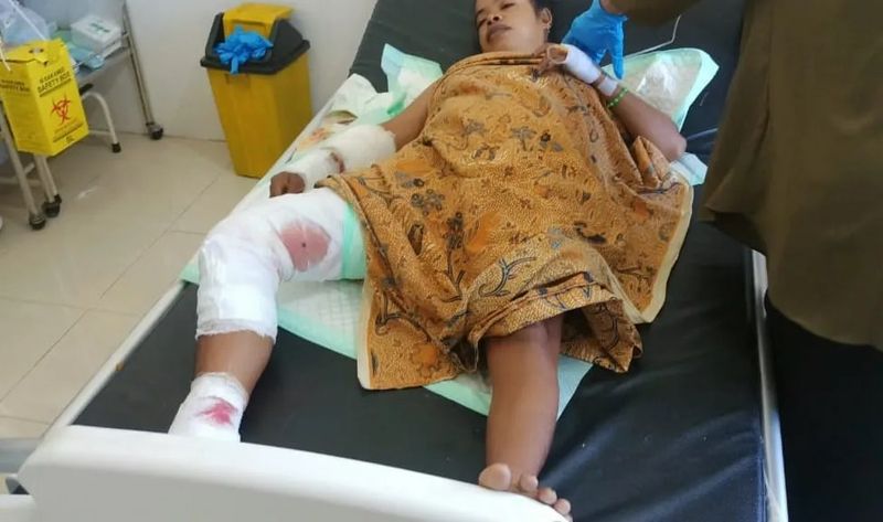 A scăpat cu viață în mod miraculos! O femeie a fost prinsă în gura unui crocodil timp de 90 de minute! 