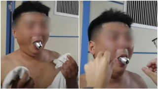 VIDEO - Un bărbat s-a prezentat la Urgențe cu un bec blocat &icirc;n gură. Curiosul văzuse provocarea pe internet și a &icirc;ncercat să o reproducă