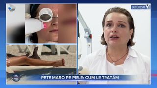 Petele pe piele: de ce apar și cum le putem trata? &bdquo;Petele pigmentare pot să apară la nivelul obrajilor sau a buzei superioare&rdquo;